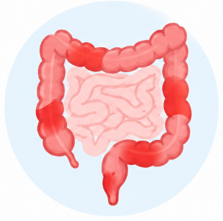 Malattia di Crohn