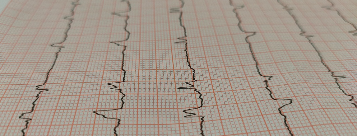 Elettrocardiogram ristretto